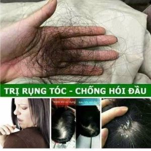 DẦU GỘI TINH CHẤT BƯỞI HÀ THỦ Ô